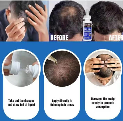 FollicaBoost™ Biotin Serum