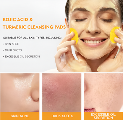 Pure Glow™ Turmeric & Kojic Acid Cleansing Pads (50 Pads)